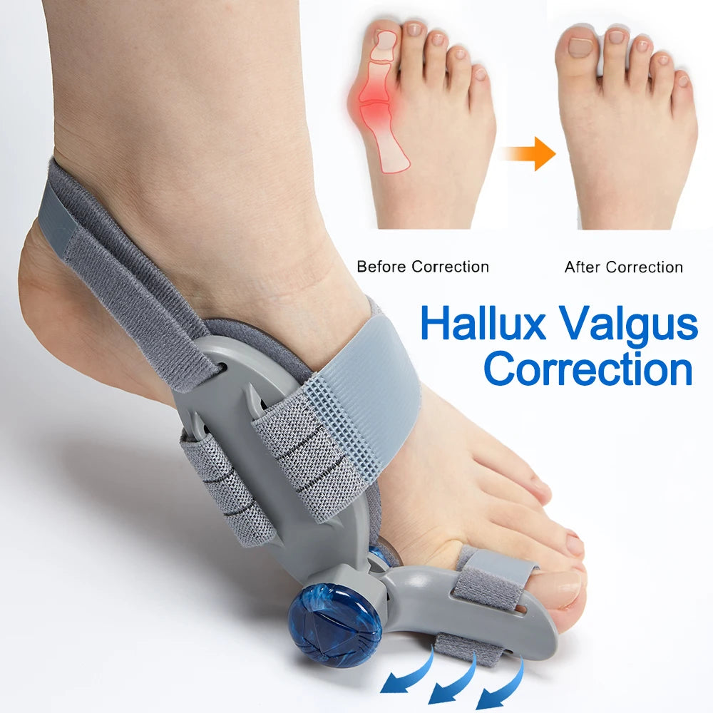 Bunion Splint Big Toe Straightener Hallux Valgus Correction Orthotics Foot Bone Thumb Adjuster Correction Pedicure Brace