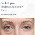 Mirluva Microneedle Eye Patches